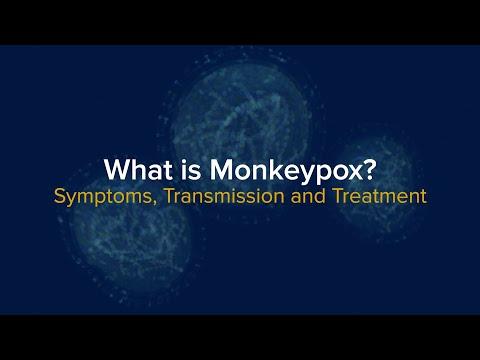 What is MPX?