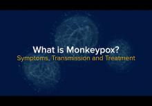 What is MPX?